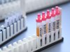 AIIMS Planning to Conduct Clinical Trial of Plasma Therapy to Treat Covid-19 Patients