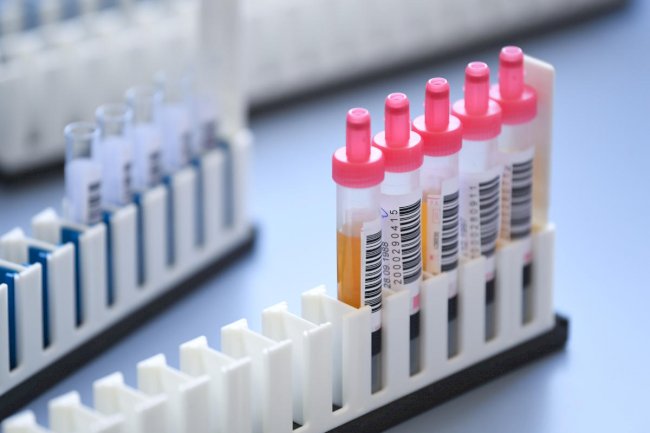 AIIMS Planning to Conduct Clinical Trial of Plasma Therapy to Treat Covid-19 Patients