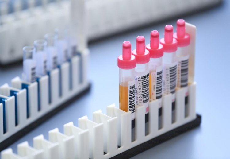 AIIMS Planning to Conduct Clinical Trial of Plasma Therapy to Treat Covid-19 Patients